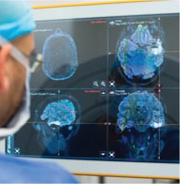 Innovative Types of Neuro-Oncology Treatment in Udaipur